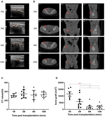 Bone Fragment Co-transplantation Alongside Bone Marrow Aspirate Infusion Protects Kidney Transplant Recipients